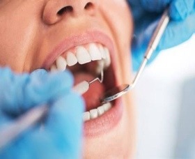 Dental Care